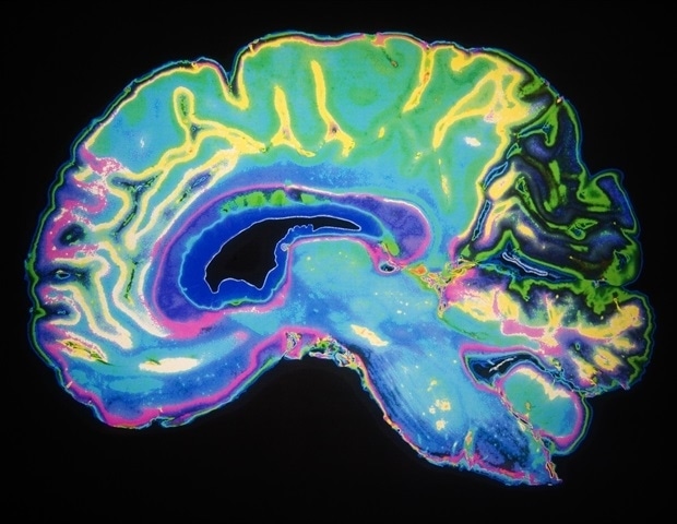 New insights into brain energy metabolism may lead to neurodegenerative disease therapies